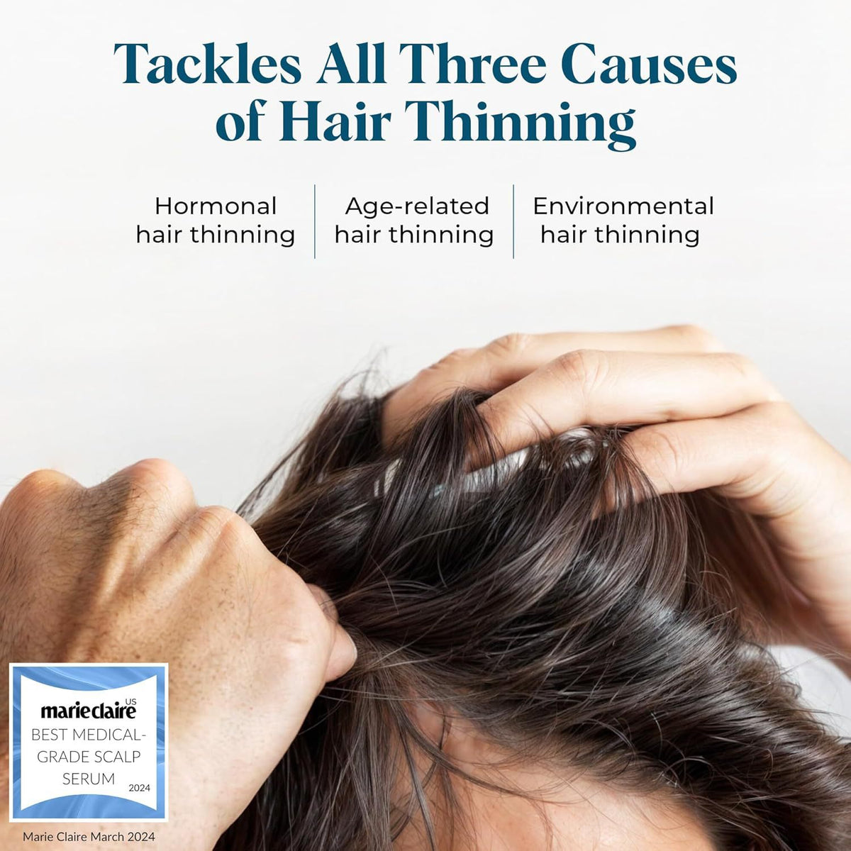 Dense Hair Moisturizing, Smooth and Shiny Hair/Hair Prevention/Hair Loss Scalp Essence 30ml